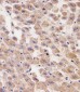 AFP Antibody